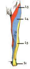 sciatique-l5-schema