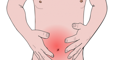 Gluten yConstipación