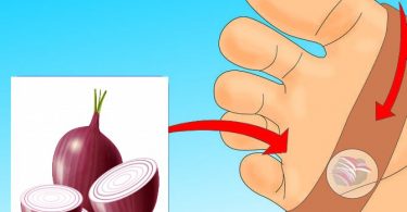 cebolla en los pies