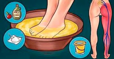 remedios caseros para la ciática con vinagre de manzana