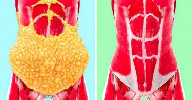 Remedios caseros para quemar grasa