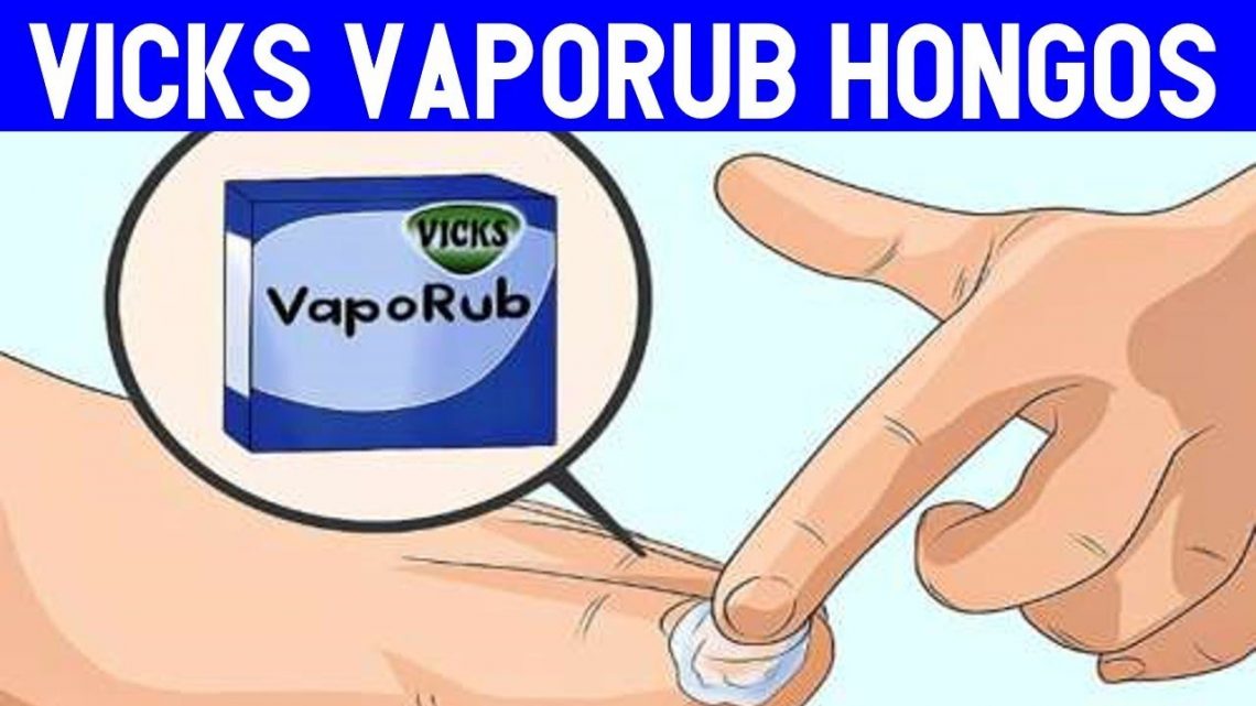 vicks vaporub para hongos en las uñas