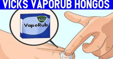 vicks vaporub para hongos en las uñas