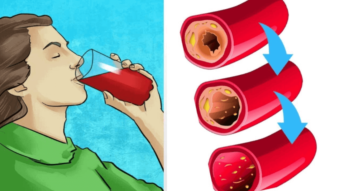 Alimentos para destapar arterias del corazón