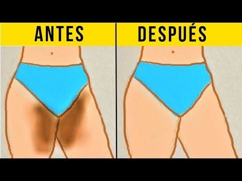 remedios caseros para aclarar la entrepierna