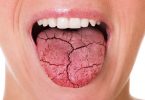 Qué nos dice la lengua sobre la salud