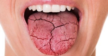 Qué nos dice la lengua sobre la salud