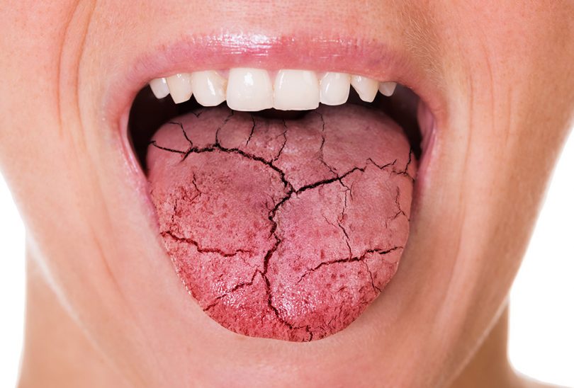 Qué nos dice la lengua sobre la salud