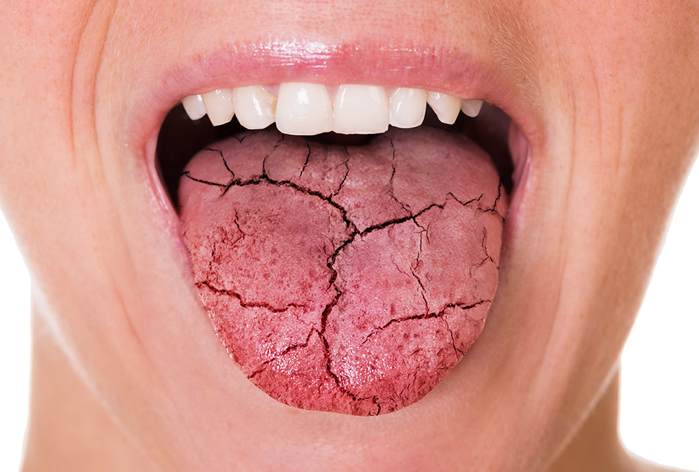 Qué nos dice la lengua sobre la salud