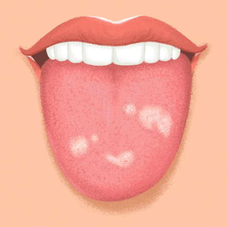 lengua y salud5