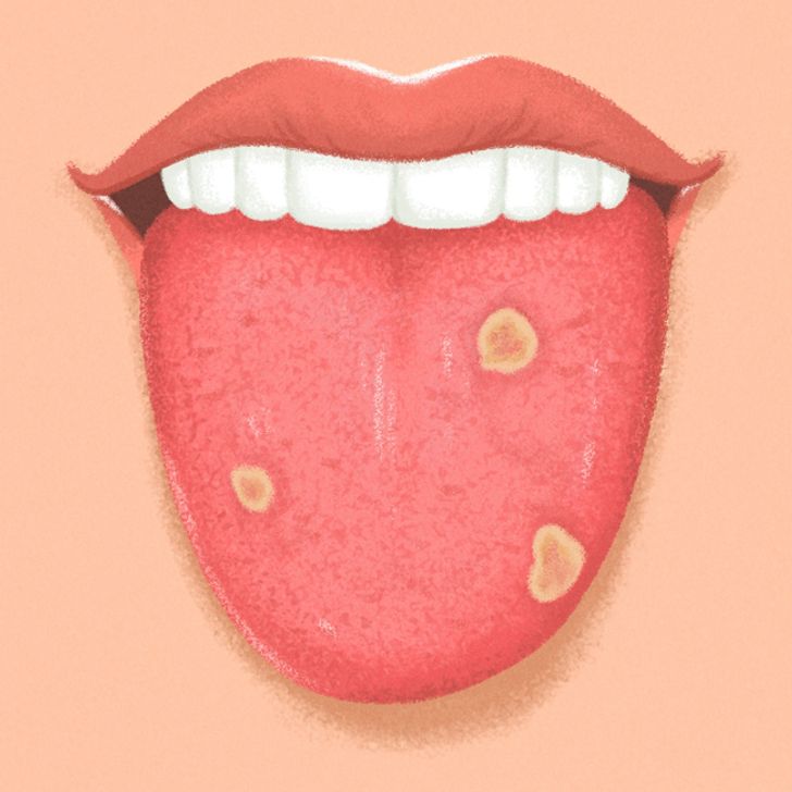 lengua y salud9