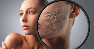 15 Mascarillas caseras para piel seca