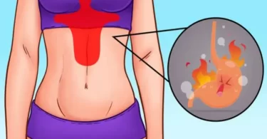 20 remedios caseros para el dolor en la boca del estómago