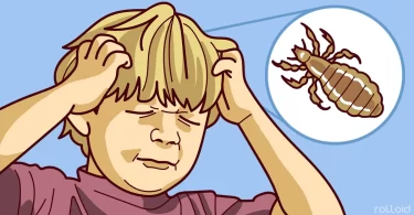 Remedios caseros para eliminar piojos y liendres definitivamente