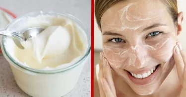 7 Cremas Caseras para las Manchas