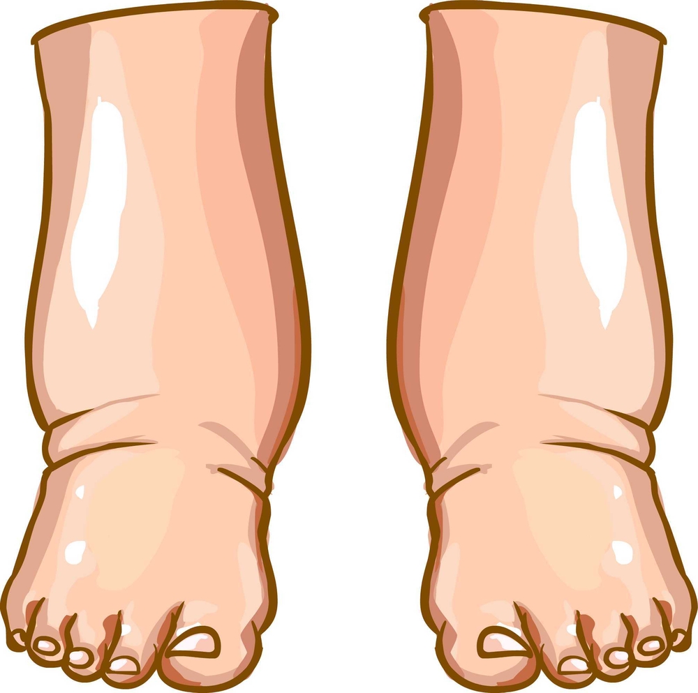 12 Remedios Caseros para Desinflamar las Piernas Hinchadas